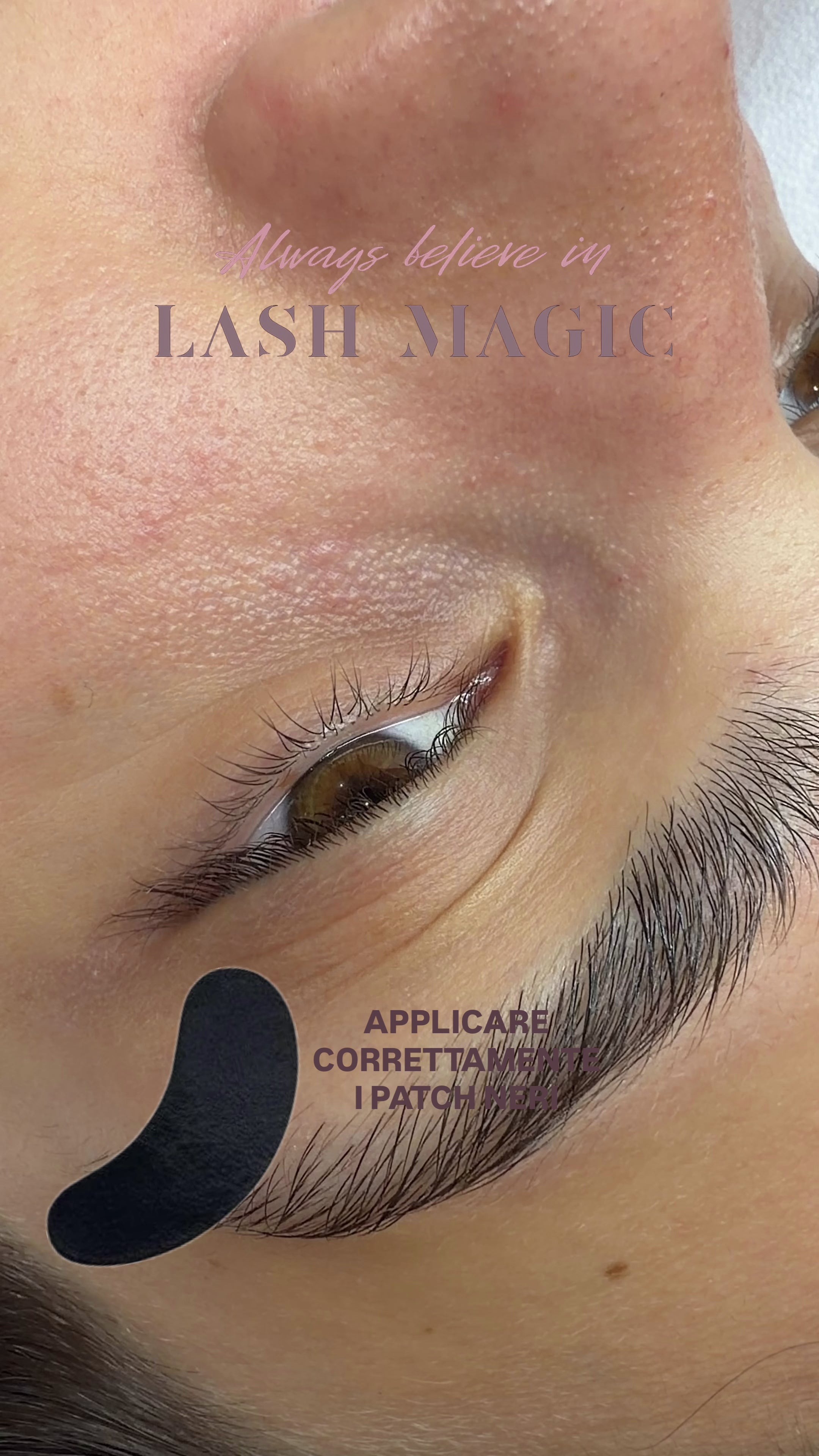 Black gel patches